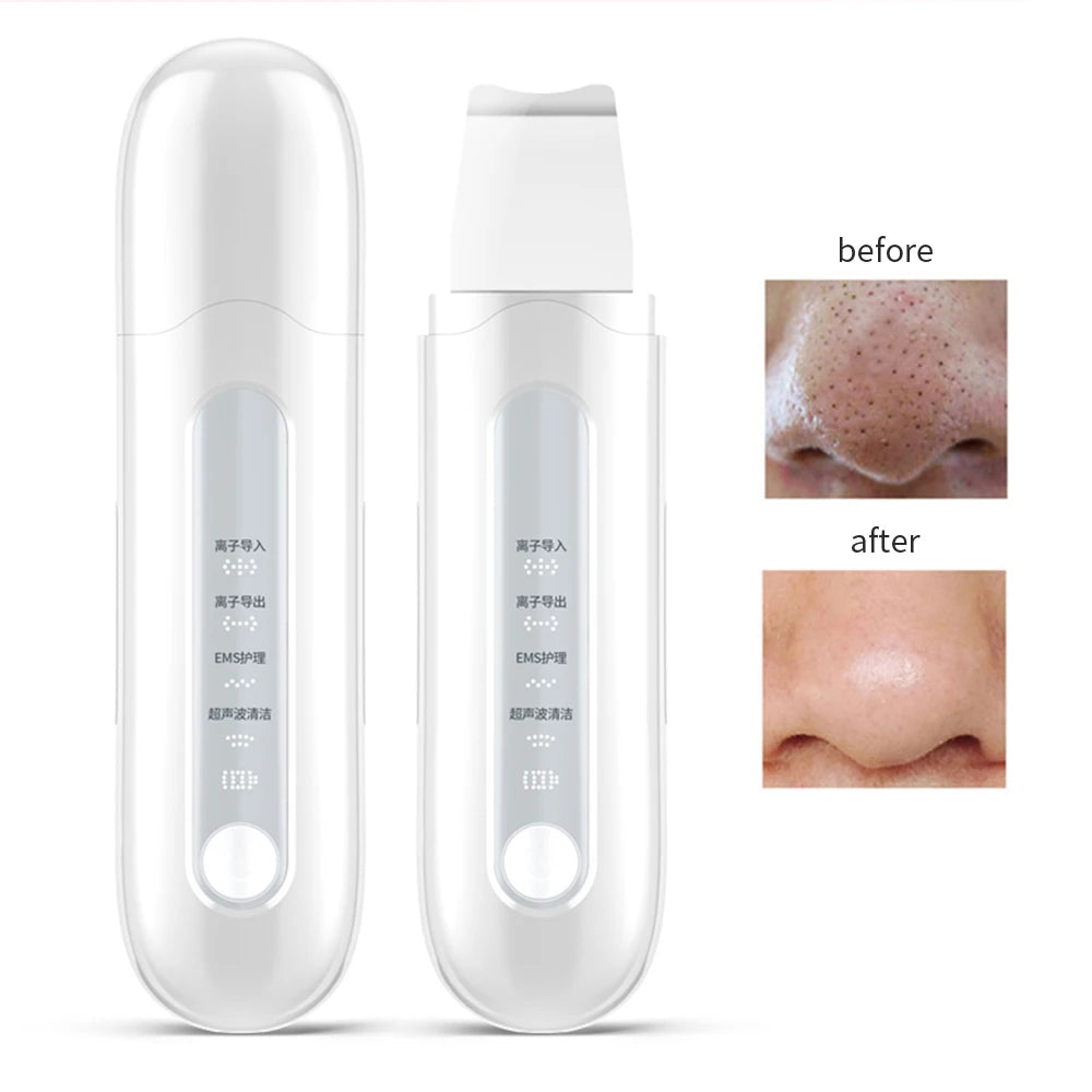 Ultrasonic Skin Scrubber Face Spatula & Pulse Massager Facial Cleansing Device PLUSH