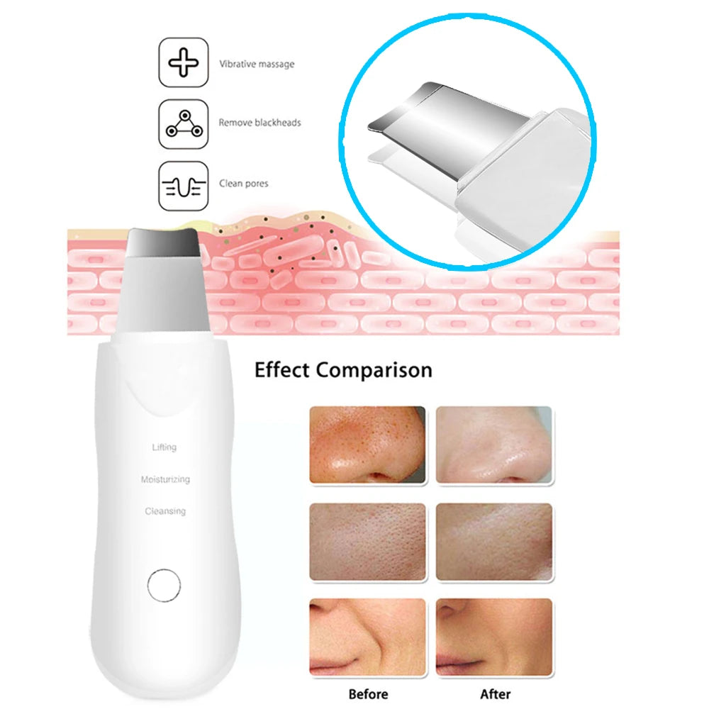Ultrasonic Skin Scrubber Facial Cleaner & Massager | CAMMUO Facial Cleansing Device PLUSH