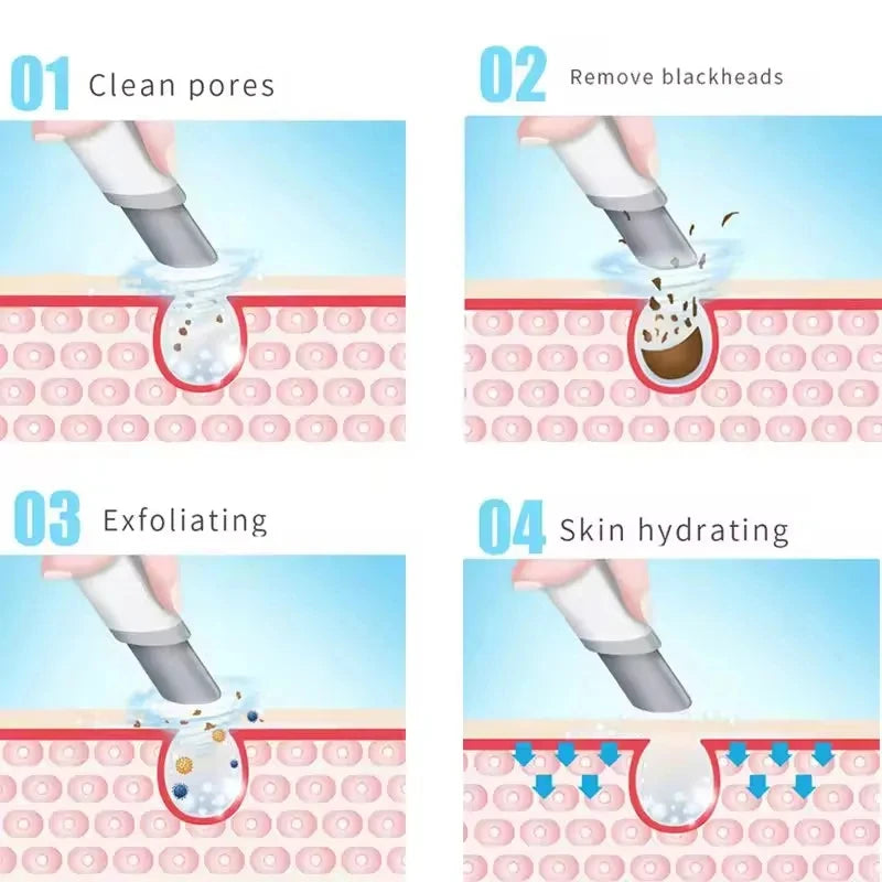 3-in-1 Aqua Peel Facial Machine | Micro Bubble Skin Cleansing Facial Cleansing Machine PLUSH