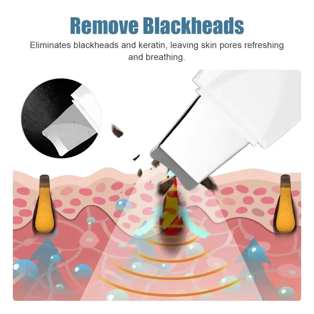 CAMMUO Ultrasonic Skin Scrubber Facial Peeling Device USB Facial Cleansing Device PLUSH