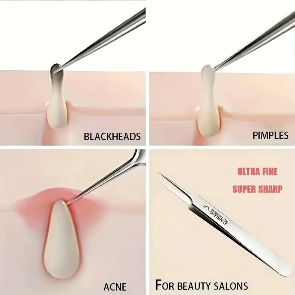 Extra Fine No. 5 Blackhead Tweezer – Precision Skin Tool Skin Care Tweezer PLUSH