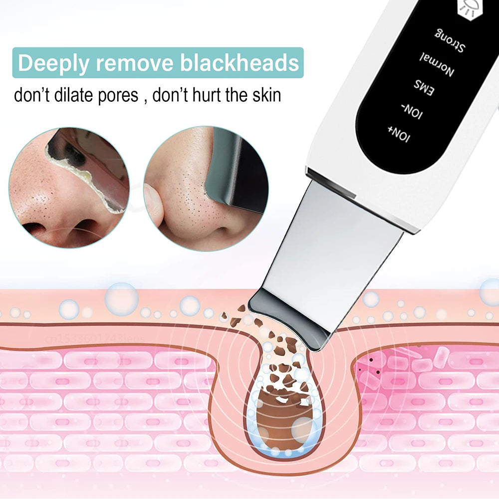 Ultrasonic Skin Scrubber – Facial Spatula & Deep Pore Cleanser Facial Cleansing Device PLUSH