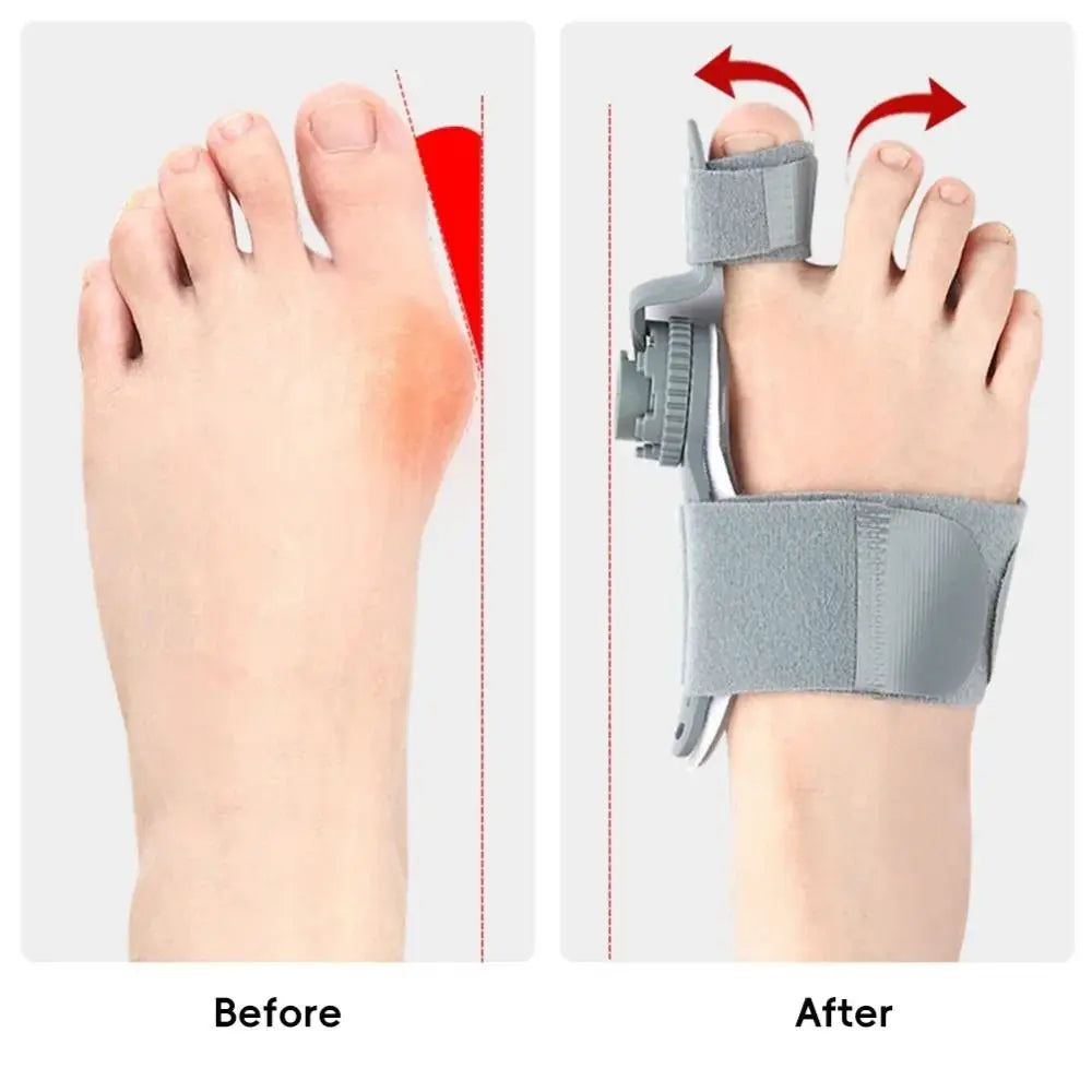 Adjustable Bunion Corrector Big Toe Straightener Brace – Unisex Toe Corrector Brace PLUSH
