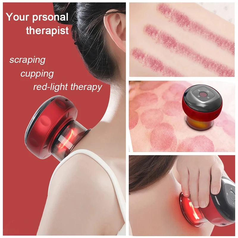 Smart Electric Heated Cupping Massager – Back, Neck & Body Electric Cupping Massager PLUSH