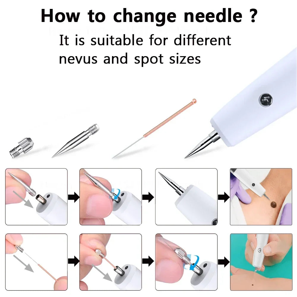 Plasma Pen Replacement Micro Needles – Spot Removal Pen Tips Micro Needle Replacement Tips PLUSH