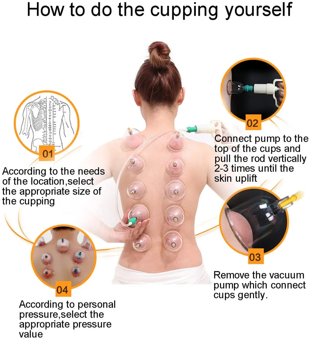 12-Piece Vacuum Cupping Set with Pump Gun | Body Massage Cupping Therapy Set PLUSH