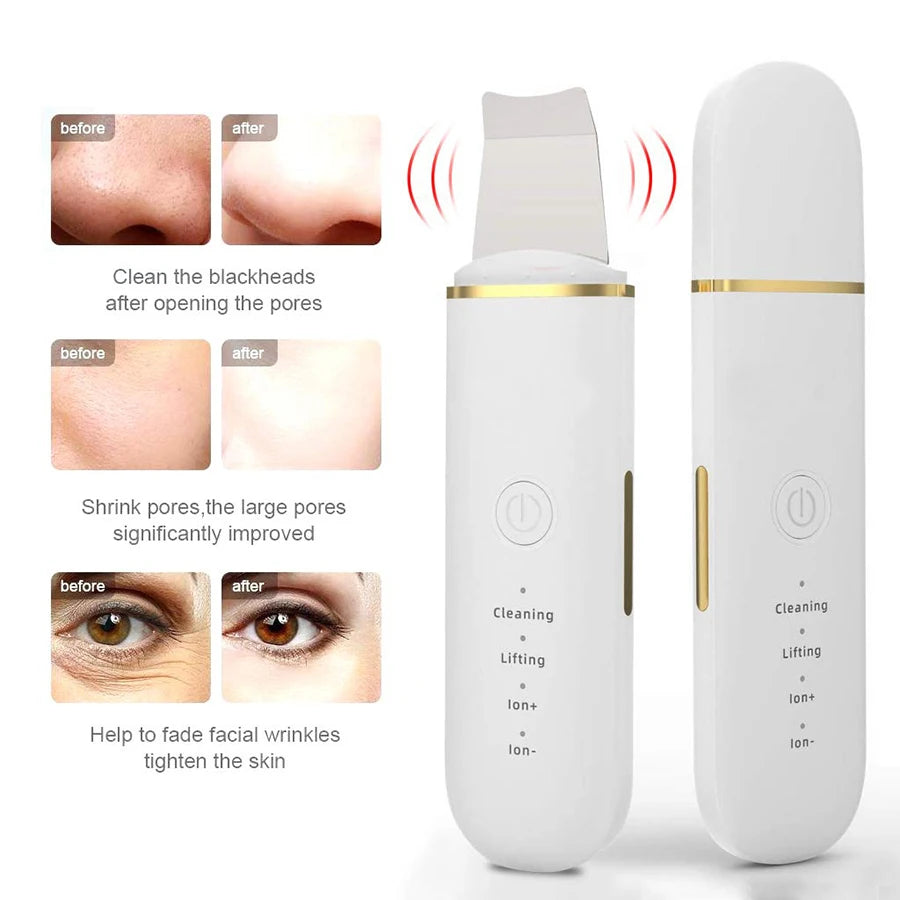 Ultrasonic Skin Scrubber Face Spatula – Pore Cleaner & Lifting Facial Cleansing Device PLUSH