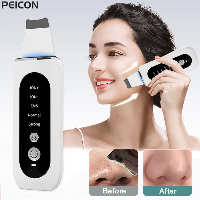 Ultrasonic Skin Scrubber – Blackhead Remover & Pore Cleanser Facial Cleansing Device PLUSH