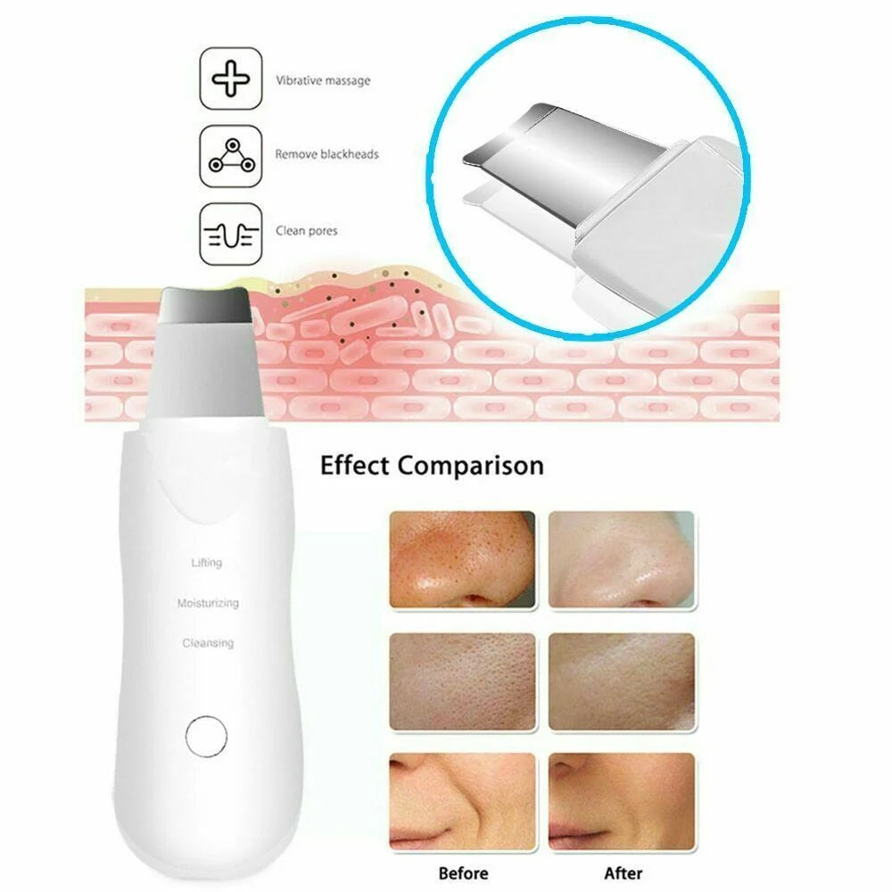 Ultrasonic Skin Scrubber Face Spatula – Blackhead Remover Facial Cleansing Device PLUSH