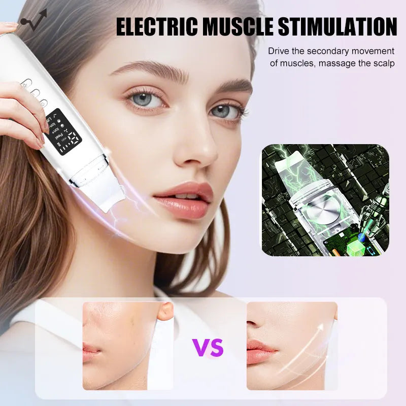 Ultrasonic Skin Scrubber Spatula – Facial Lifting & Deep Cleansing Facial Cleansing Device PLUSH