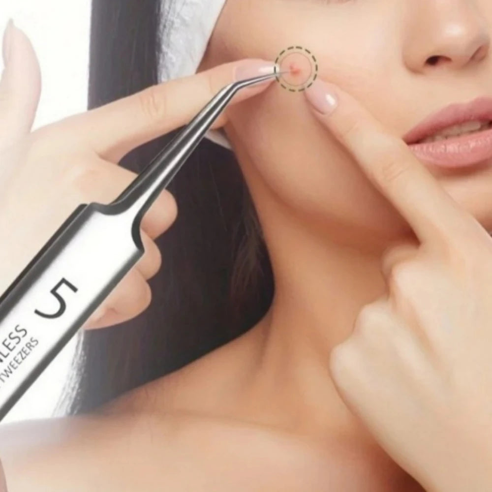 Extra Fine No. 5 Blackhead Tweezer – Precision Skin Tool Skin Care Tweezer PLUSH