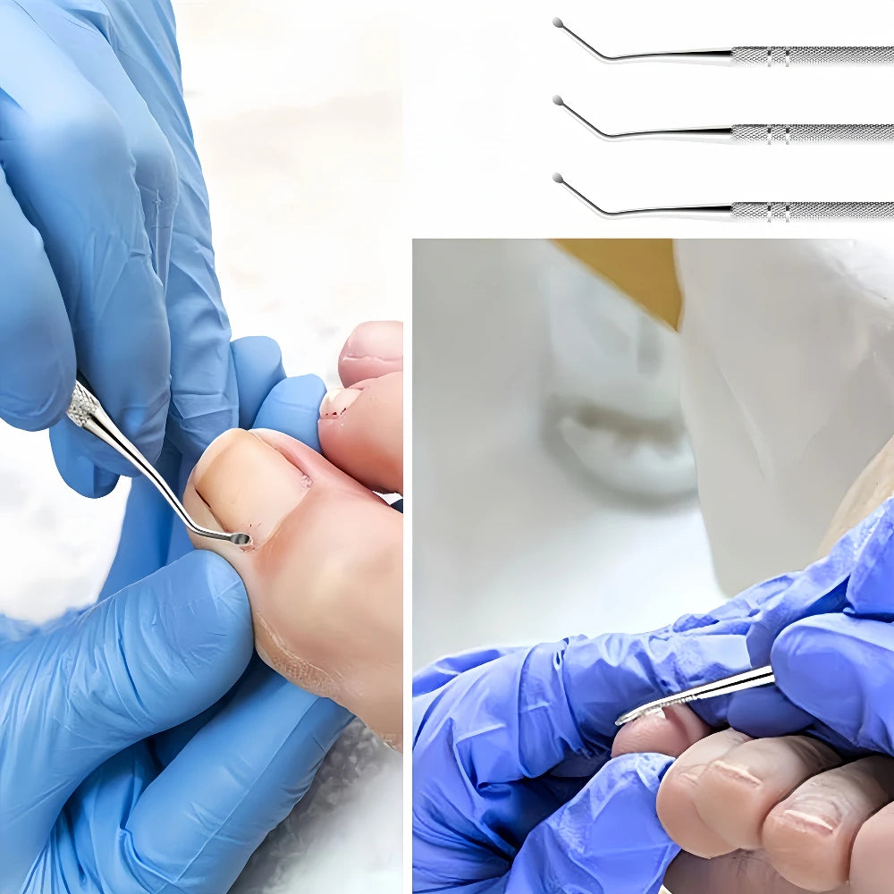 Stainless Steel Pedicure Nail Groove Spoon Set – 1/3/5pcs Pedicure Nail Tool PLUSH