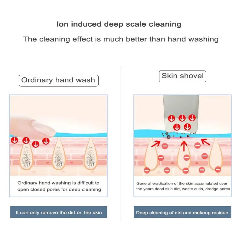 Ultrasonic Skin Scrubber Spatula – 4-Mode Facial Lifting Tool Facial Skin Scrubber PLUSH