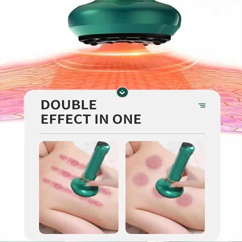 Electric Cupping Massager – Infrared Heat & Vacuum Suction Electric Cupping Massager PLUSH