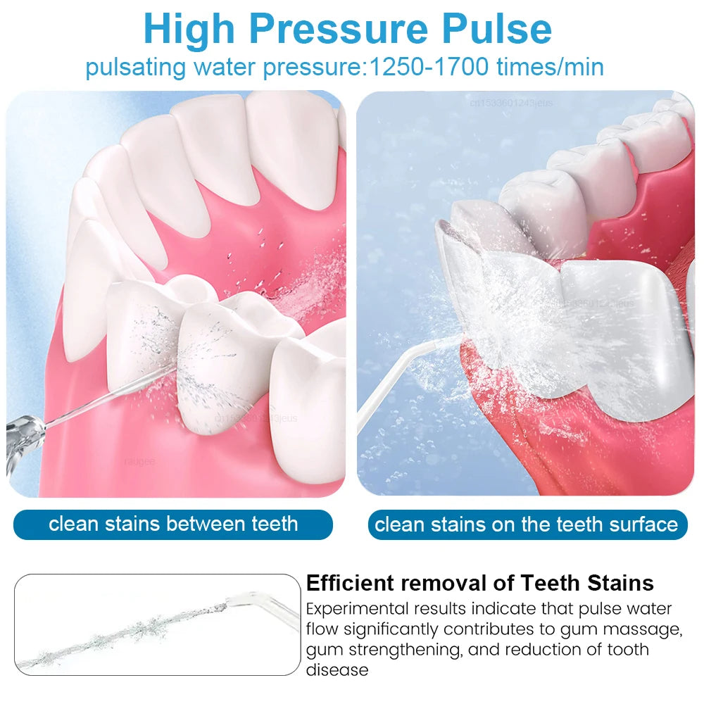 Raugee 800ML Electric Dental Water Flosser | 5 Nozzles, 10 Modes Oral Irrigator PLUSH