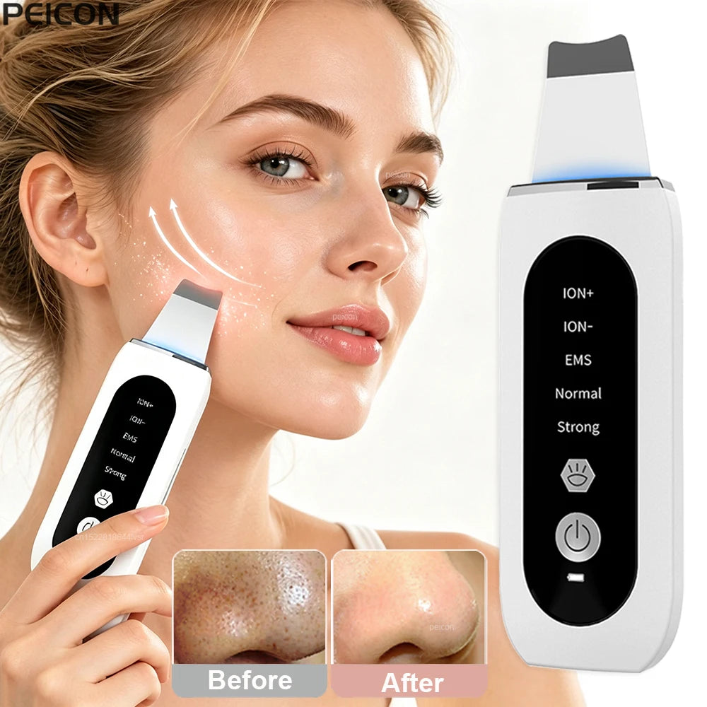 Ultrasonic Skin Scrubber – Facial Spatula & Deep Pore Cleanser Facial Cleansing Device PLUSH