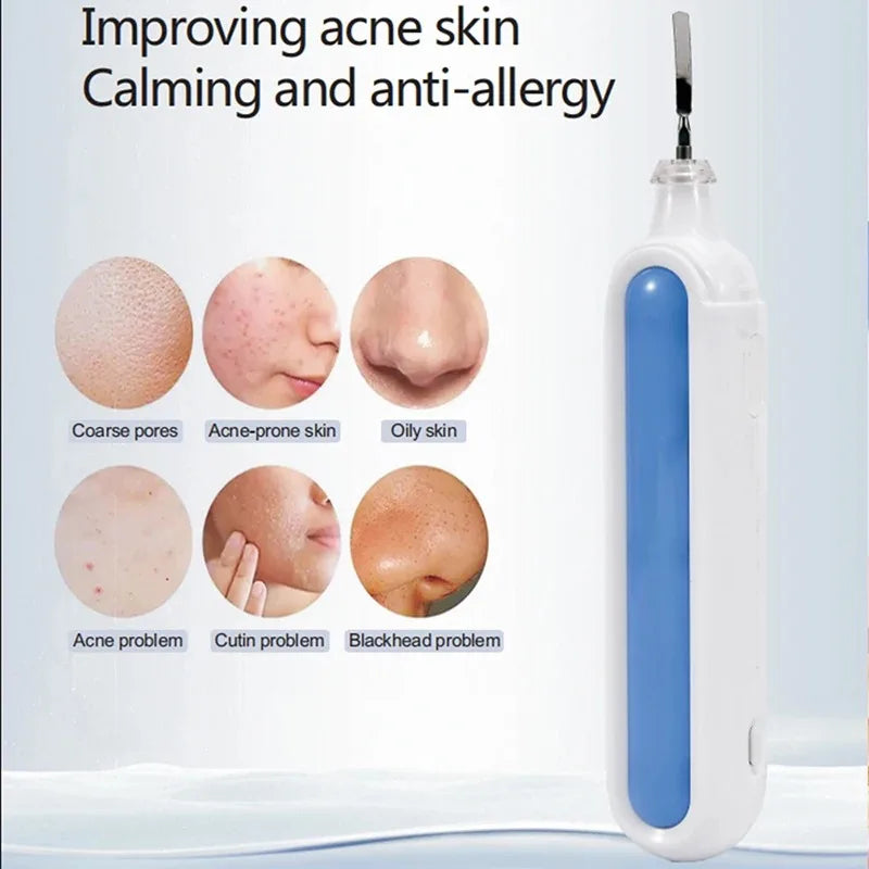Ultrasonic Skin Scrubber Spatula – Pore Cleansing Face Tool Ultrasonic Facial Scrubber PLUSH