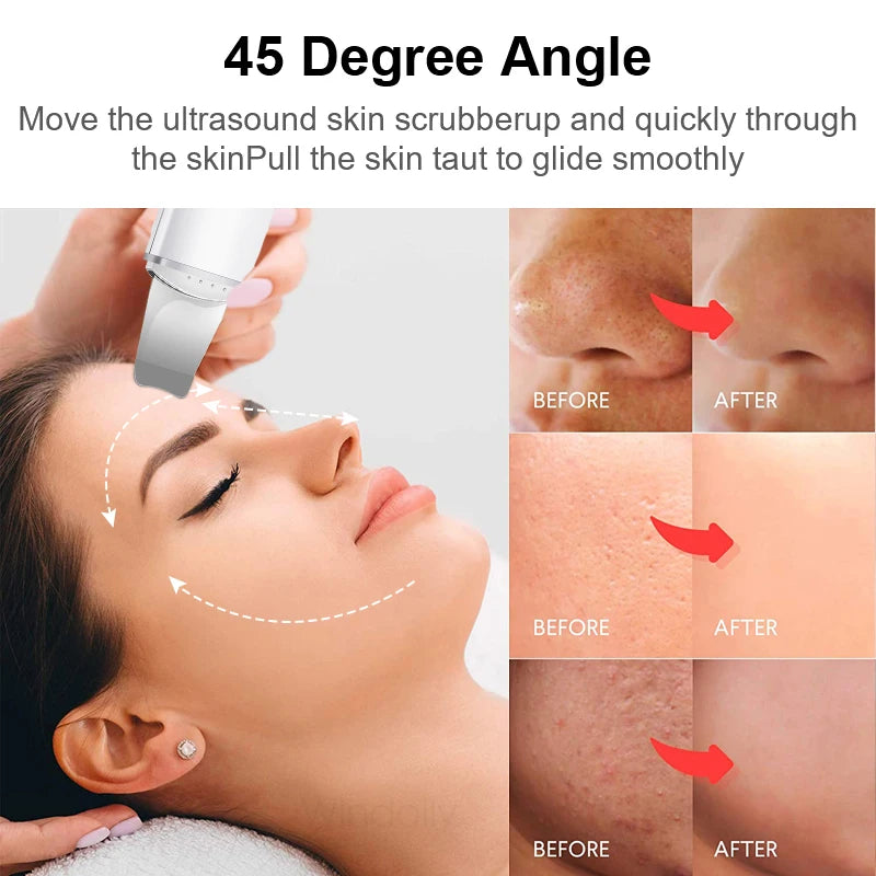 Ultrasonic Skin Scrubber Face Spatula – Cavitation Peeling Tool Facial Cleansing Device PLUSH