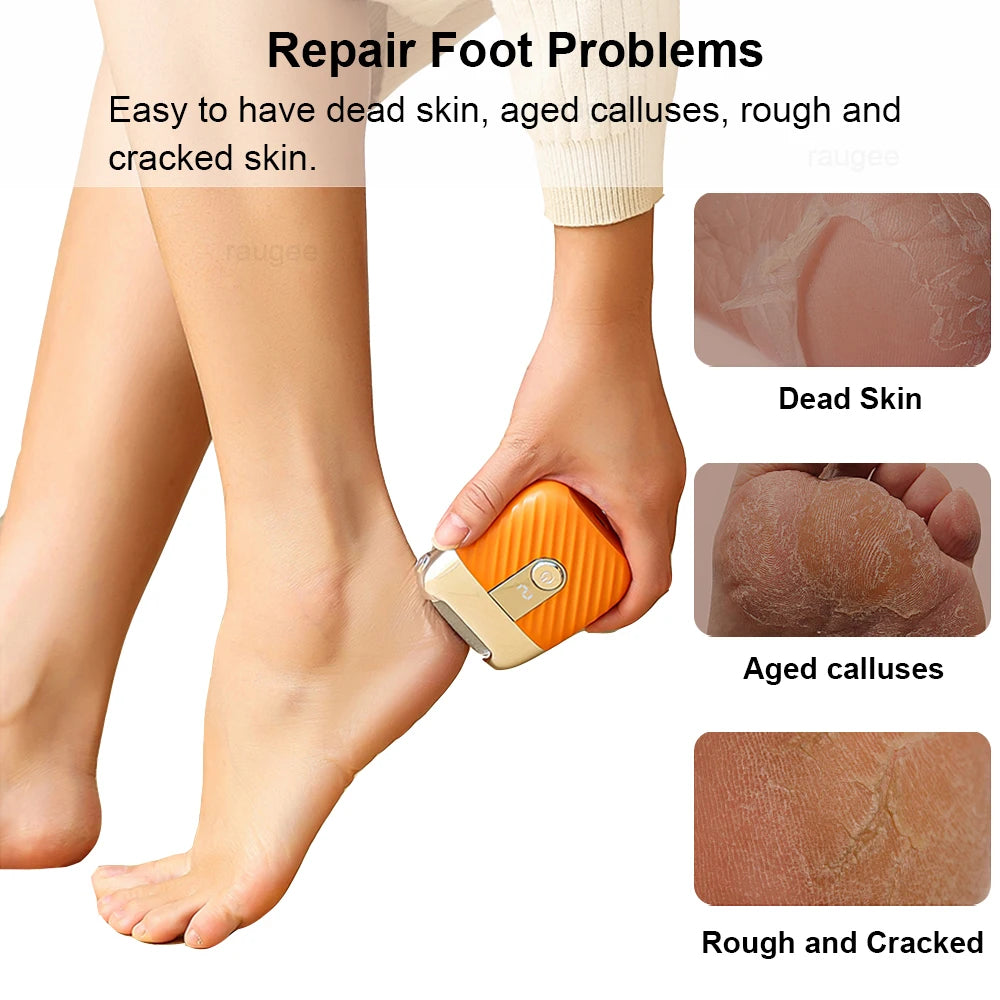 Raugee Electric Callus Remover – Rechargeable Foot File Electric Callus Remover PLUSH
