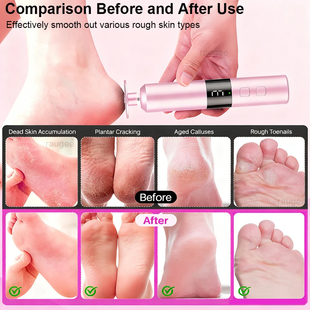 Electric Foot Callus Remover & Pedicure File – raugee Electric Foot File PLUSH