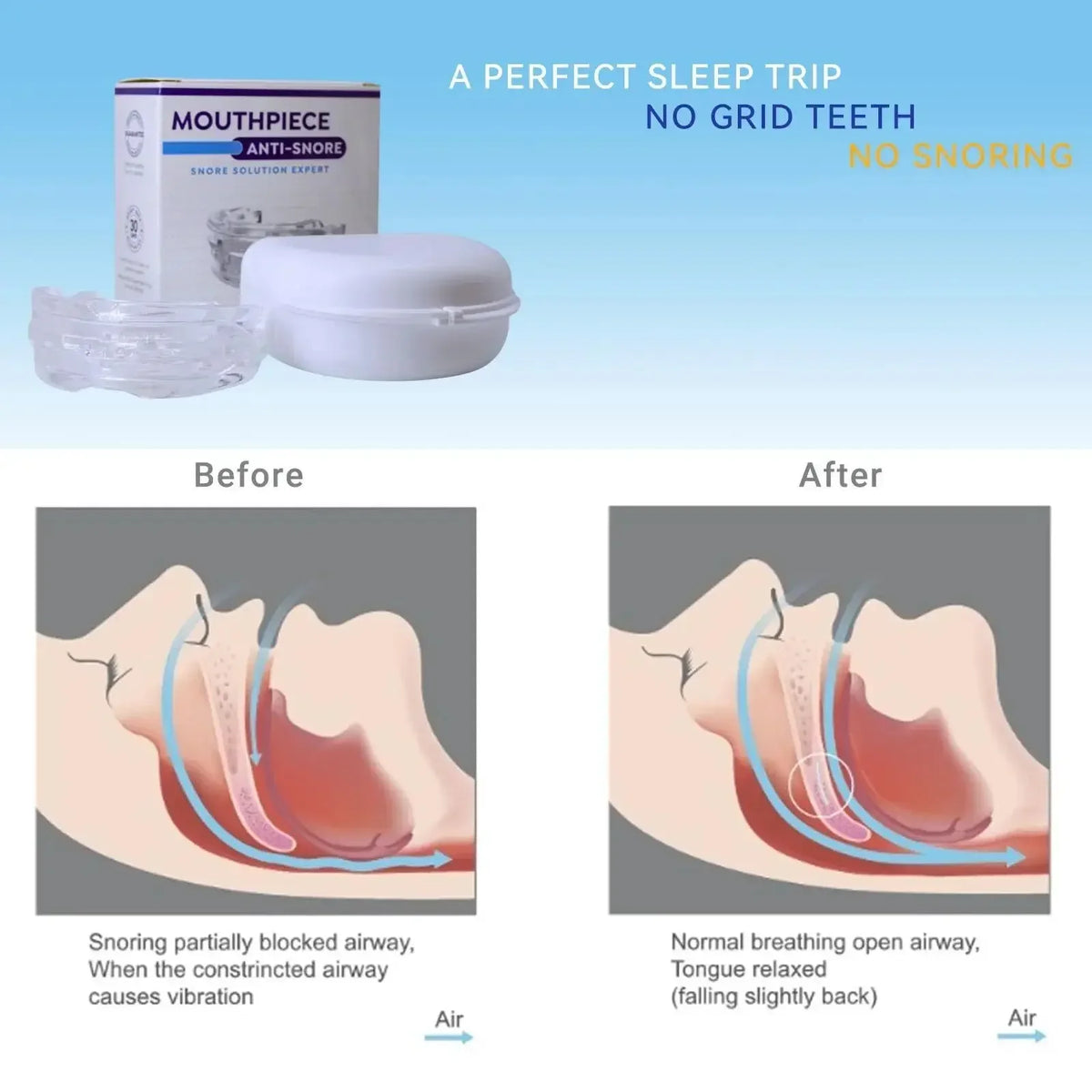 Anti-Snoring Mouth Guard – Custom-Fit Sleep Mouthpiece Sleep Mouth Guard PLUSH