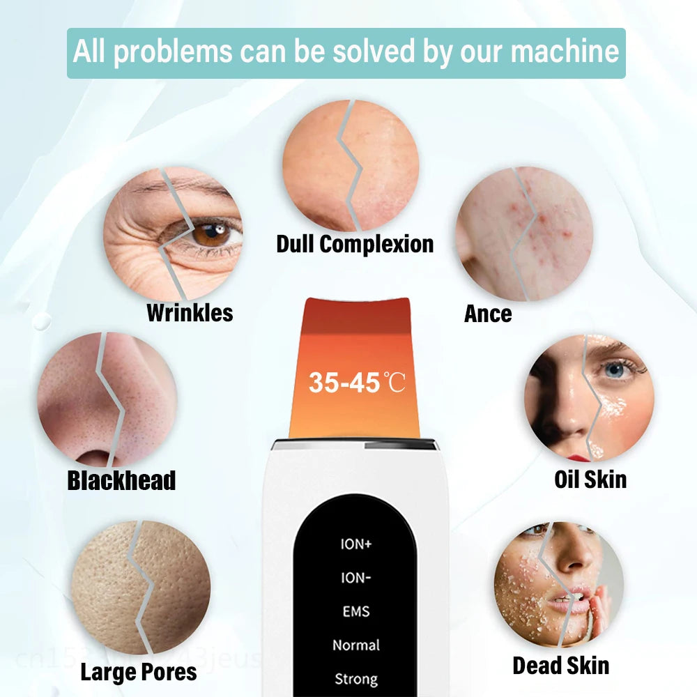 Ultrasonic Skin Scrubber Spatula – Deep Pore Facial Cleanser Facial Cleansing Device PLUSH