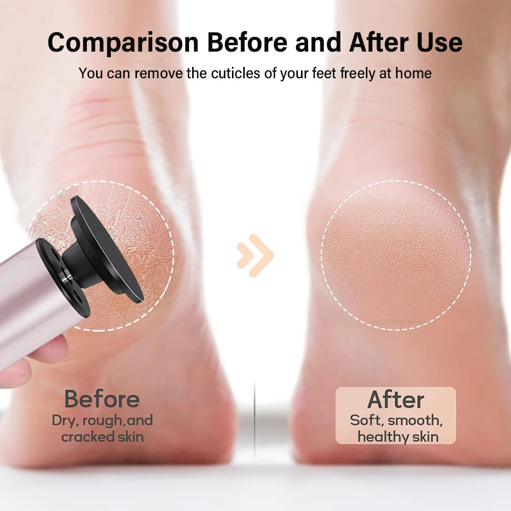 Electric Callus Remover & Foot Sander – 9-Speed Pedicure Electric Callus Remover PLUSH