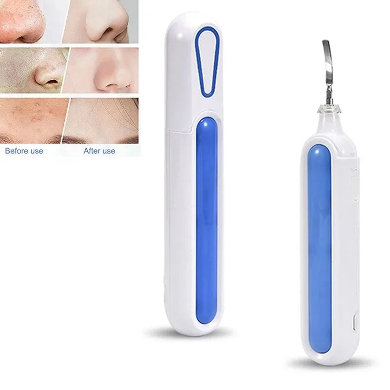 Ultrasonic Skin Scrubber Spatula – Pore Cleansing Face Tool Ultrasonic Facial Scrubber PLUSH