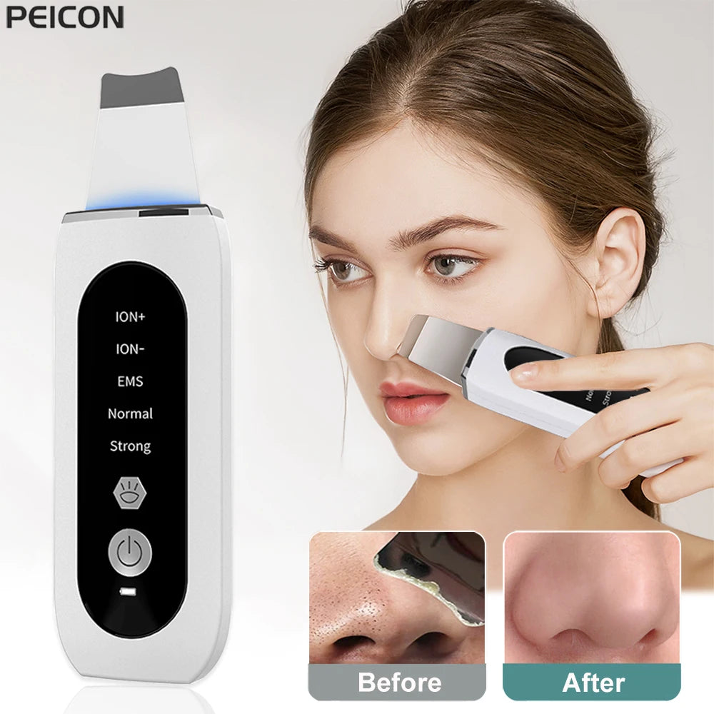 Ultrasonic Skin Scrubber Facial Spatula – Deep Pore Cleanser Facial Cleansing Device PLUSH